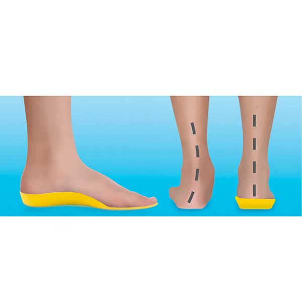 Footlogics KIDS FULL-LENGTH Orthotics